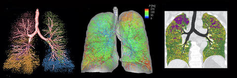 images of lungs